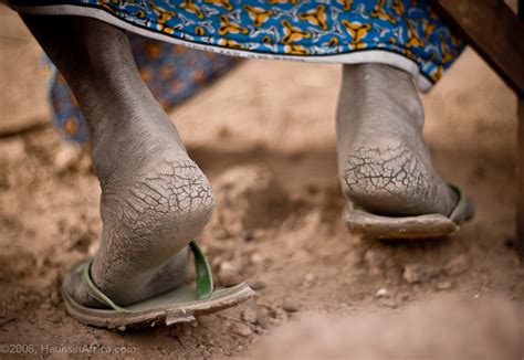 african female feet|13,846 African Feet Stock Photos & High.